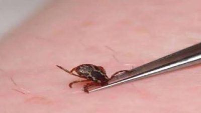 Türkiye’de yaz aylarının başlamasıyla birlikte kene vakalarının arttığı ve bu