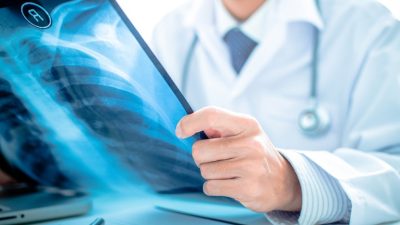 Türk TORAKS Derneği geçtiğimiz yıl Türkiye’de 41 bin kişiye akciğer