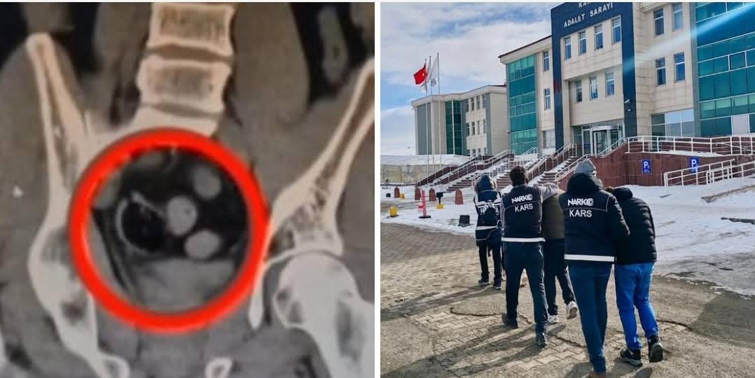 Kars’ta İranlı 3 kişinin bağırsağında uyuşturucu ele geçirildi – Birlik Haber Ajansı KARS-BHA Kars Emniyet Müdürlüğü Narkotik Suçlarla Mücadele Şube Müdürlüğünce uluslararası